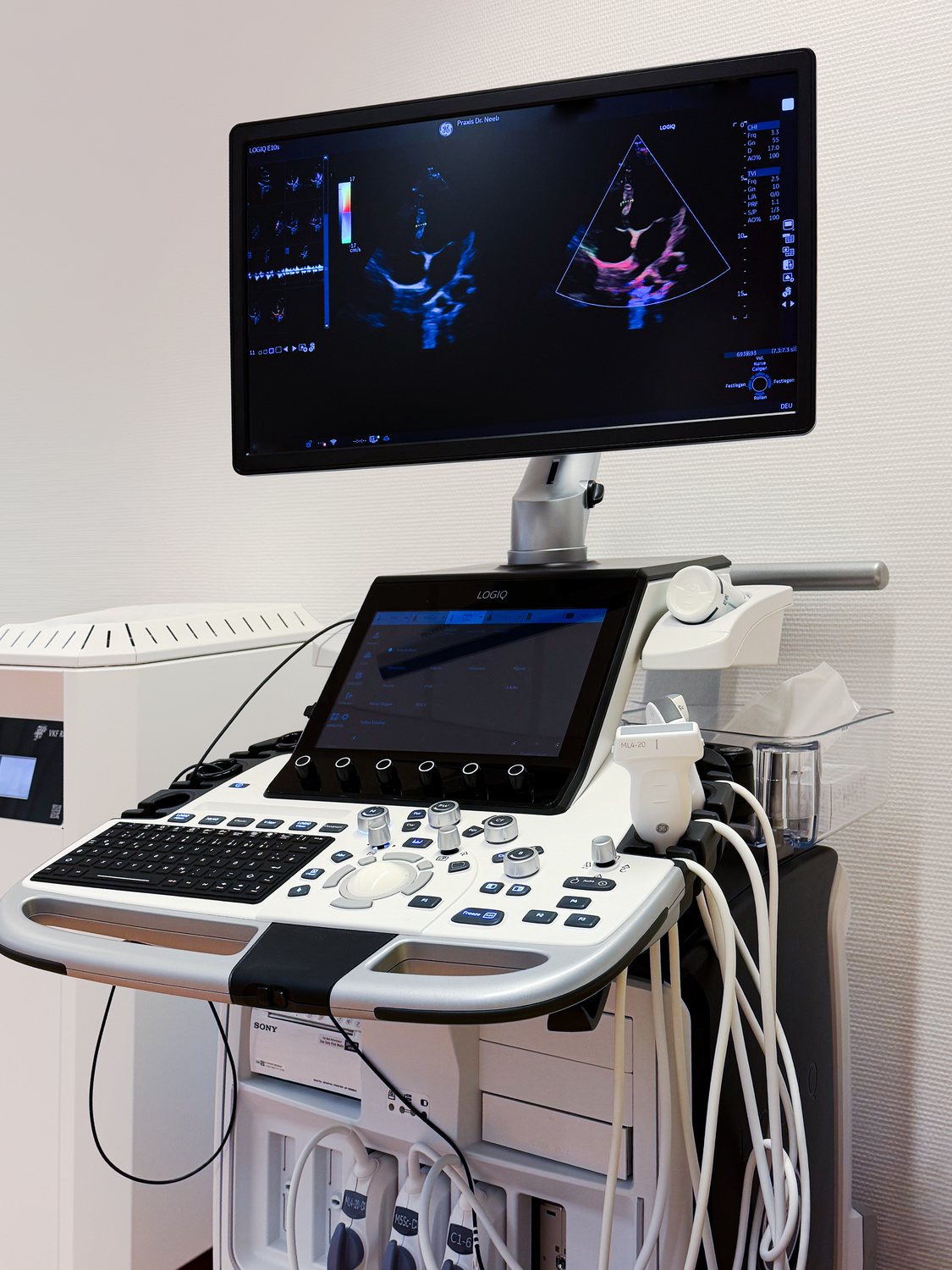 Das Ultraschallgerät LOGIQ E10s mit Bedienkonsole, Sonden und einem Echokardiographiebild auf dem Monitor